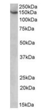 AGTPBP1/NNA1 Antibody