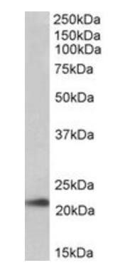 TMEM205 (aa142-151) Antibody