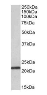 TMEM205 (aa137-146) Antibody