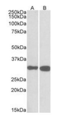 Goat anti-PDXP Antibody