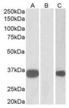 KCNIP3 Antibody