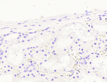 NOX1 antibody