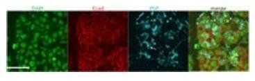 Psp antibody