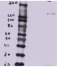 BTBD7 Antibody