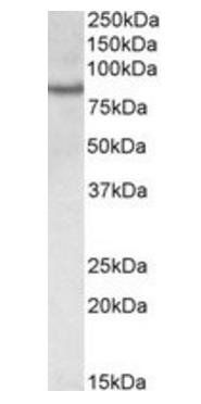 CRTC2/TORC2 (aa 83-96) Antibody