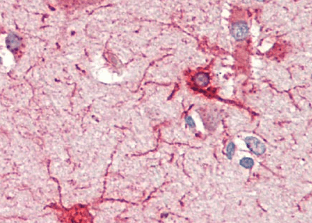 Goat anti-Crot (rat) (aa178-199) Antibody