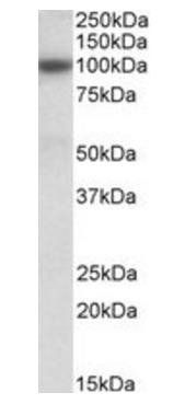 Goat anti-ABCC4 (aa70-82) Antibody