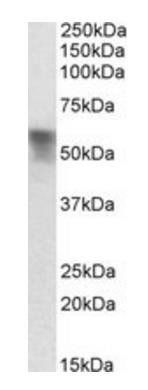 Goat anti-Transcortin / CBG (rat) Antibody