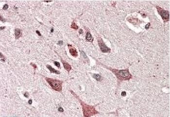 MOBKL3 (aa137-151) Antibody