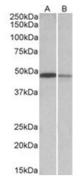 TXNDC5 antibody