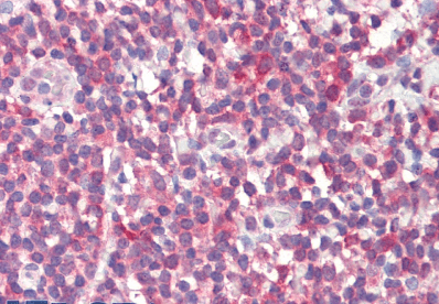 MTHFD1L (aa535-538) Antibody