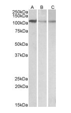 MTHFD1L (aa535-538) Antibody