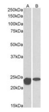 Goat anti-MNSOD (aa119-130) Antibody