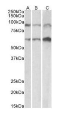 Goat anti-ADAM12 (aa225-239) Antibody