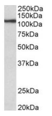 Goat anti-Thyroid peroxidase Antibody