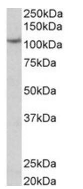 Goat anti-thyroid peroxidase Antibody