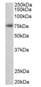 Amyloid beta peptide (aa1-16) Antibody