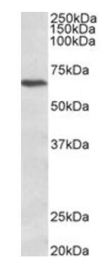 CACNB2 (aa565-579) Antibody