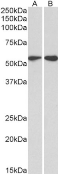 Vimentin antibody