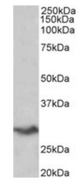VTCN1 (aa153-165) Antibody