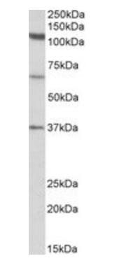 Goat anti-CP110 Antibody