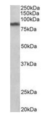 Goat anti-SLC6A3 / DAT Antibody