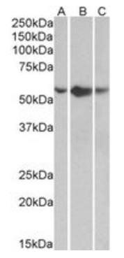 TNFR1 antibody