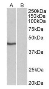 TBP /Transcription factor IID (isoform1) Antibody