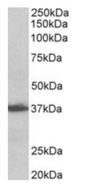 Goat anti-AIMP1 / SCYE1 (aa137-149) Antibody
