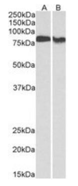 PRKCB Antibody