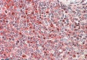 PRKCB Antibody