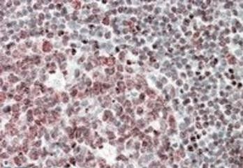 Goat anti-Fubp1 (mouse, aa160-174) Antibody