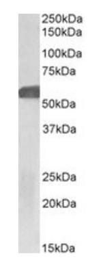 GLP1R Antibody