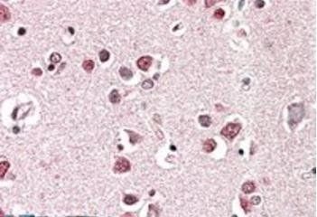 Goat anti-Endophilin-A1 / SH3GL2 Antibody