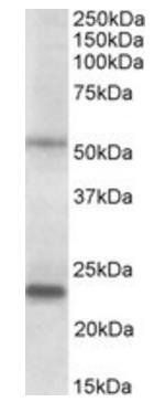 Goat anti-MMP3 (aa459-473) Antibody