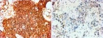 Goat anti-ERBB2 / HER2 (aa182-194) Antibody