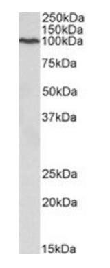 CDC48/ VCP/YDL126C (baker's yeast, aa128-142) Antibody