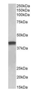 Goat anti-cardiac troponin T (aa201-213) Antibody