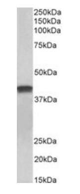 TNNT2 antibody