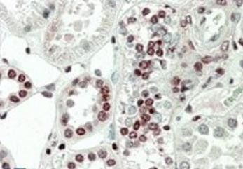 Goat anti-MK5 / MAPKAPK5 (aa192-206) Antibody