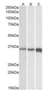 Goat anti-TNNT3 Antibody