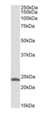 Goat anti-TNNI1 Antibody