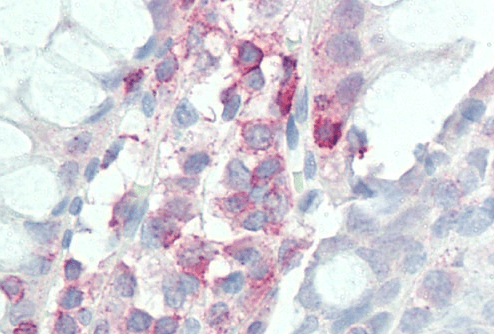 IL17D antibody