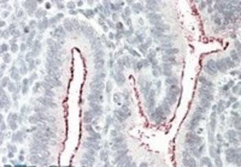 Goat anti-BCAR1 Antibody
