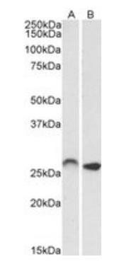Goat anti-HOXC6 (isoform 1) Antibody