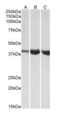 ALDOA Antibody