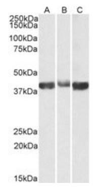ALDOA (aa86-96) Antibody