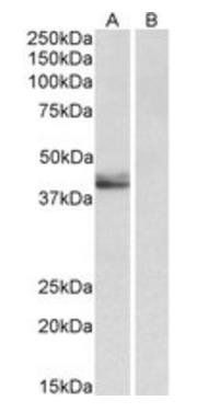 Goat anti-SERPINB1 (aa130-143) Antibody