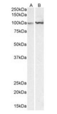 Goat anti-ACTN1 (aa596-609) Antibody