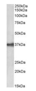Goat anti-EPCAM / TROP1 (aa167-179) Antibody